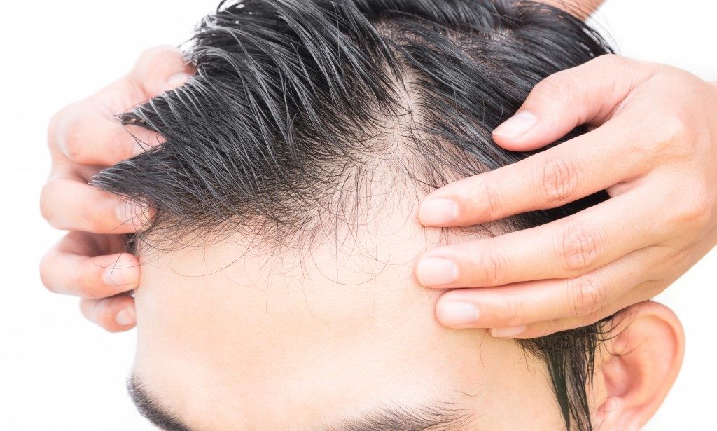 Young man worry hair loss problem for health care shampoo and beauty product concept